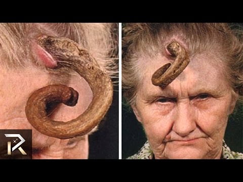 Watch Shocking Medical Conditions That You Won't Believe Exists