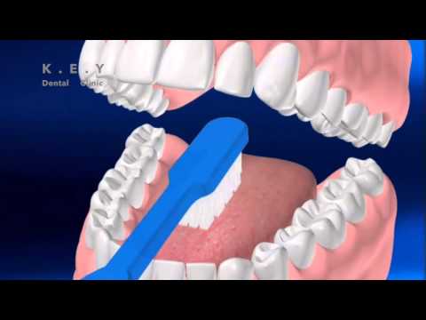 Watch This Patient Education Video on How to Maintain Oral Health